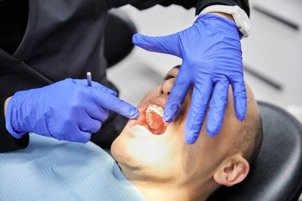 Best Chipped Tooth Repair Near Me  in Medical Lake, WA