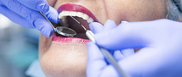 Best Knocked-Out Tooth Emergency  in Medical Lake, WA